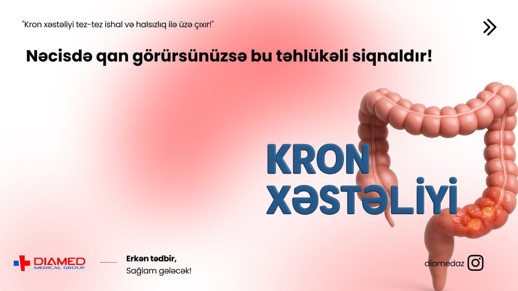 kron-xesteliyi