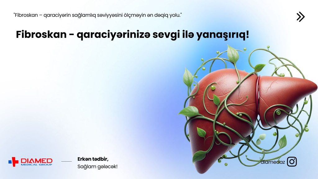 fibroskan