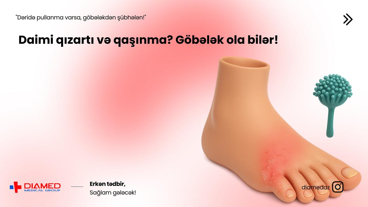 Göbələk Xəstəliyi – Dərinin, dırnaqların və orqanizmin səssiz düşməni