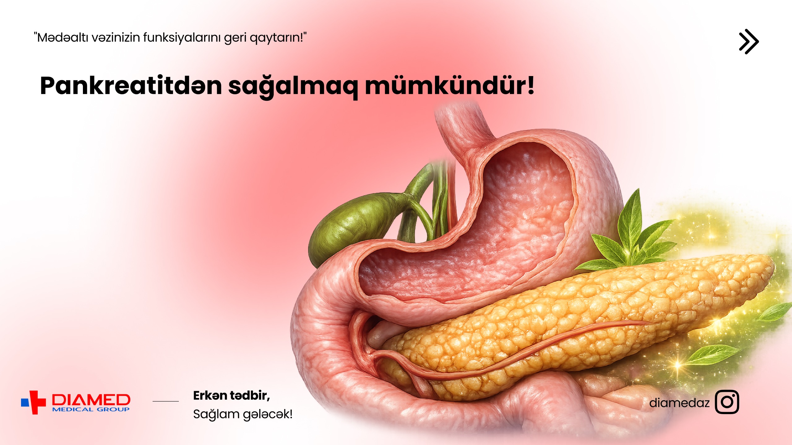 Pankreatitin müalicəsi – Mədəaltı vəzin sağlamlığını qorumağın əsas yolları