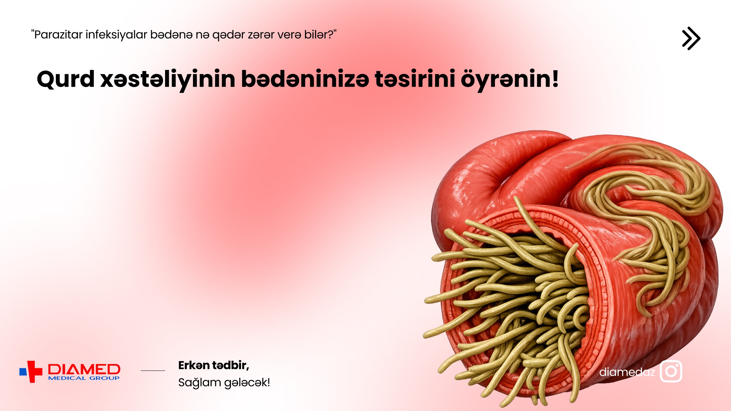 Qurd xəstəliyi – Parazitar infeksiyalar və sağlamlığa təsiri