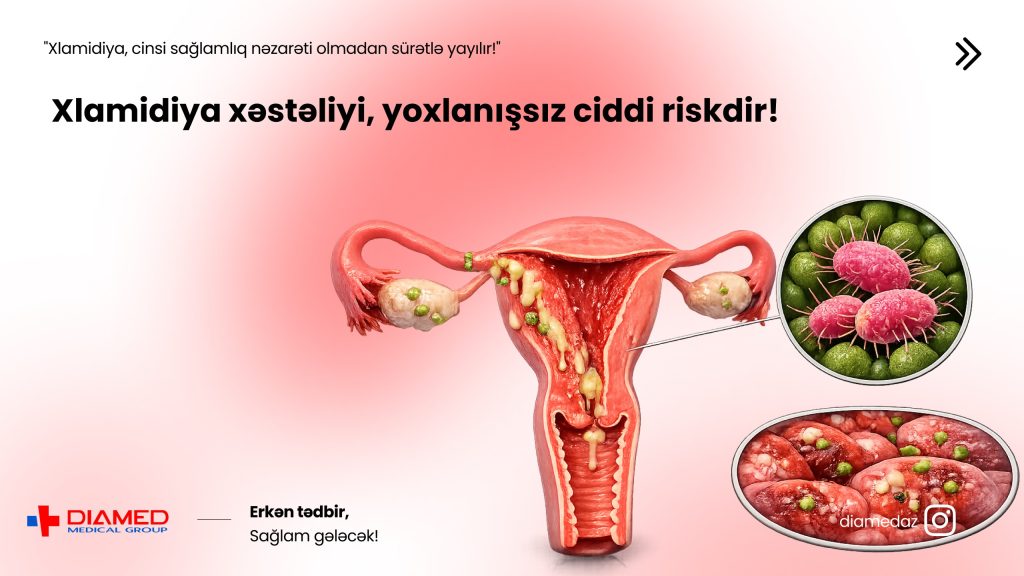 🦠 Xlamidiya xəstəliyi – Gizli gedən, lakin ciddi fəsadlar yarada bilən infeksiya
