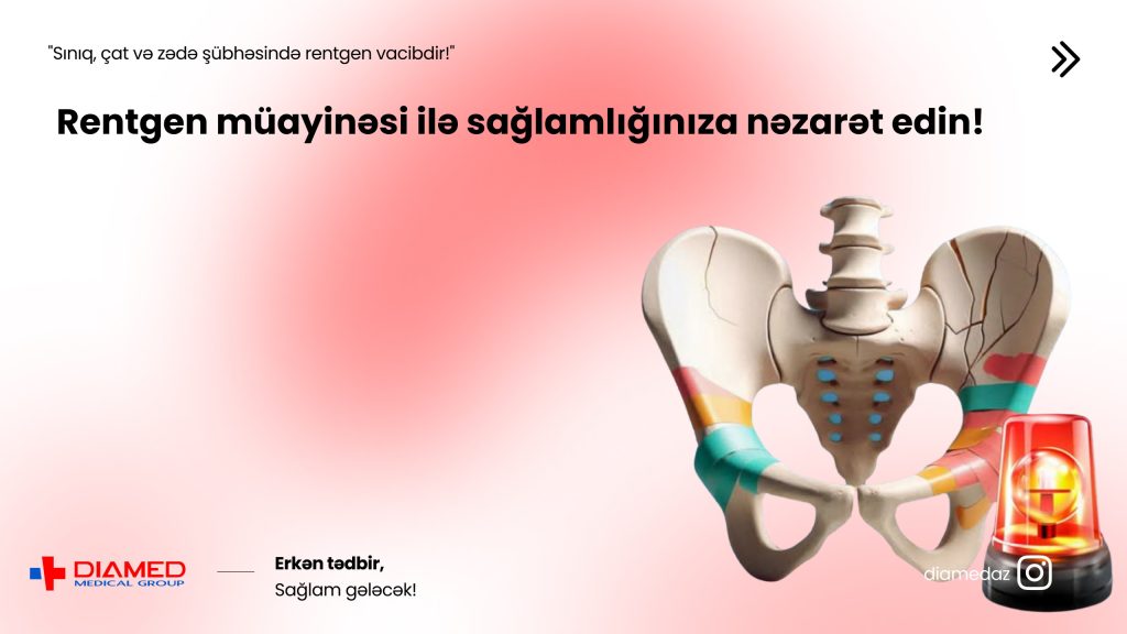Rentgen Müayinəsi: Sümük və Ağciyər Xəstəliklərinin Dəqiq Diaqnostikası