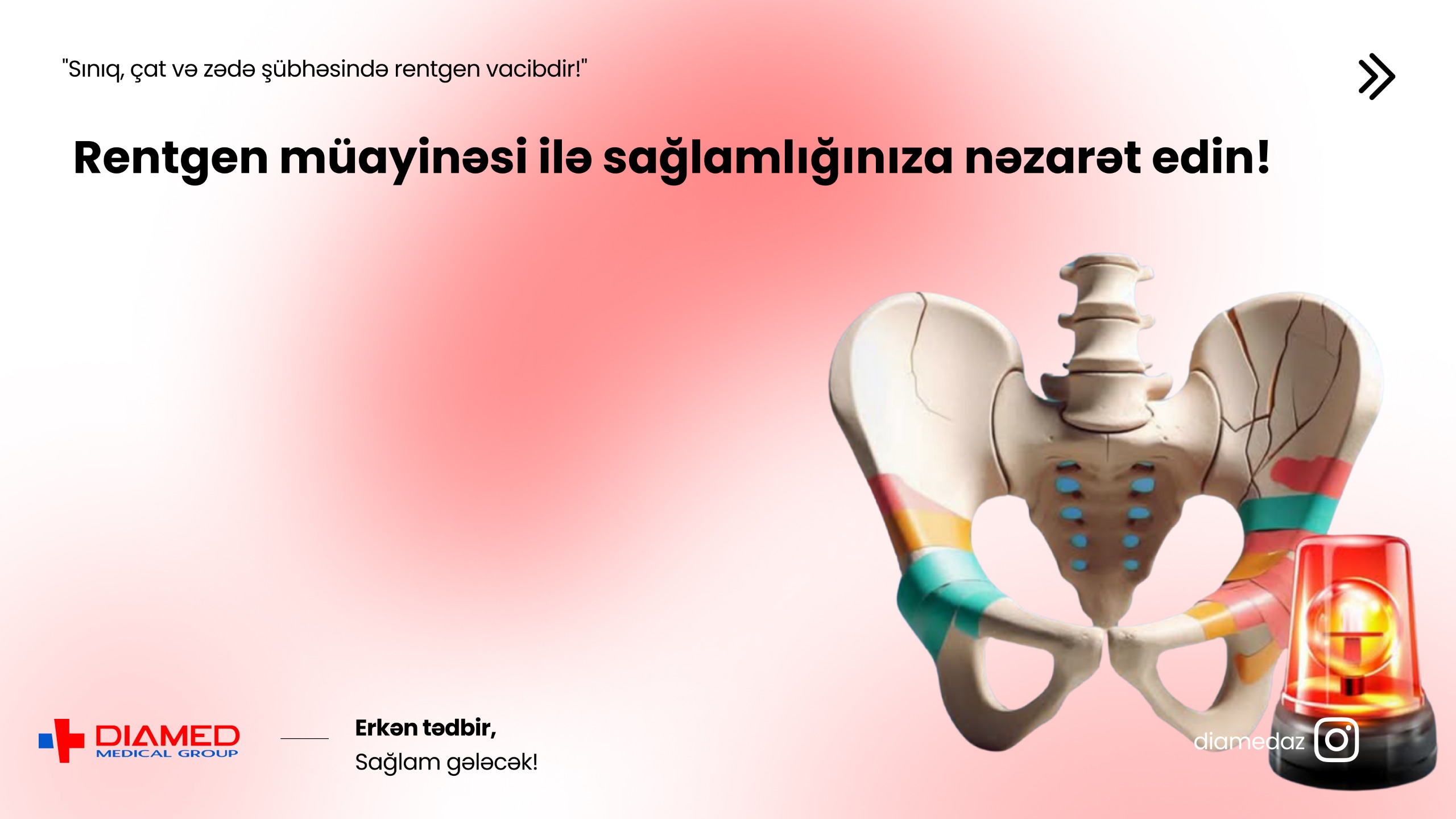 Rentgen Müayinəsi: Sümük və Ağciyər Xəstəliklərinin Dəqiq Diaqnostikası